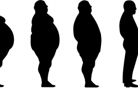 המסת שומן לבעלי עודף משקל